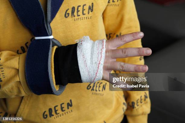 Encasing Finger 1,726 Finger Cast Stock Photos, High-Res Pictures, and Images - Getty ...