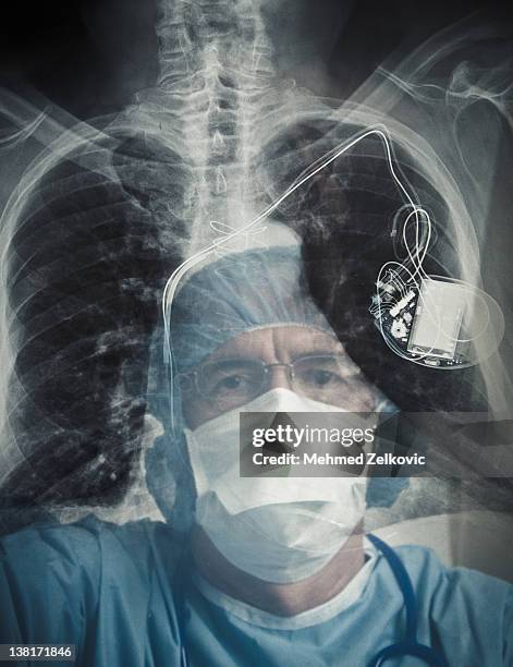 Foto Pacemaker Pacemaker Xray Foto e immagini stock - Getty Images