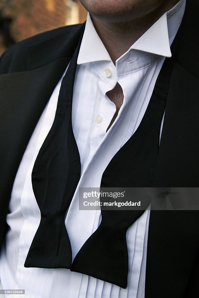 Man with untied black bowtie and unbuttoned white shirt