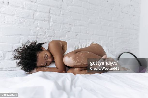 woman with vitiligo resting on bed at home - acostado de lado fotografías e imágenes de stock