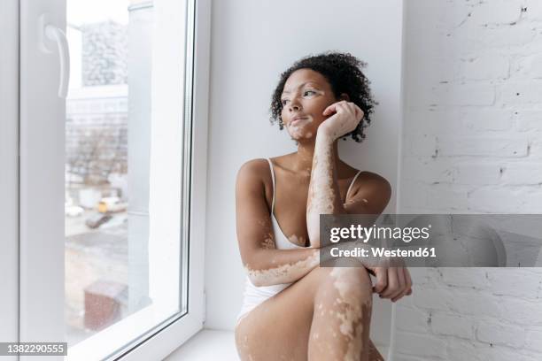 woman with vitiligo looking through glass window at home - vitiligo stock-fotos und bilder