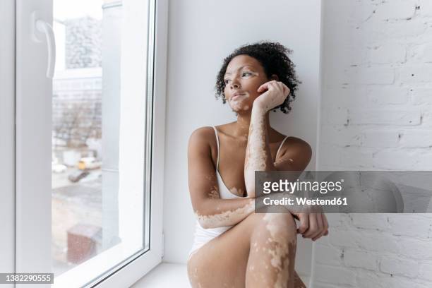woman with vitiligo looking through glass window at home - vitiligo stock pictures, royalty-free photos & images