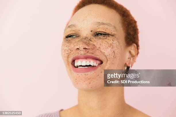 toothy smile - faces freckles stockfoto's en -beelden