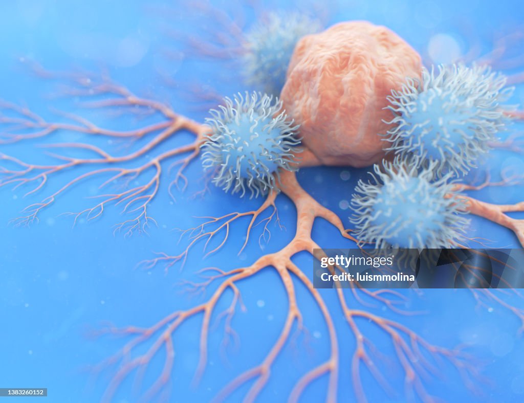 NK-Zelle (Natural Killer Cell) greift eine Krebszelle an