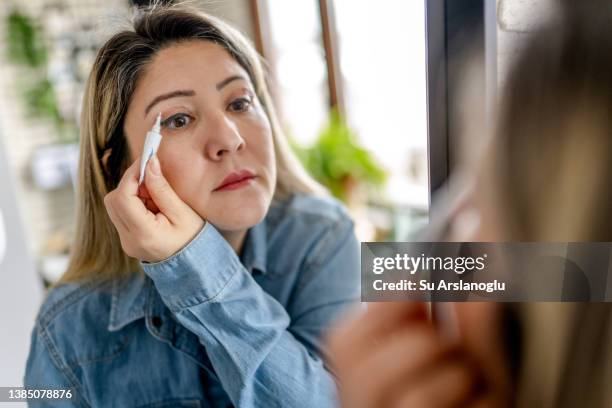 woman having eyelid surgery applies eye cream at home - blepharisma stockfoto's en -beelden