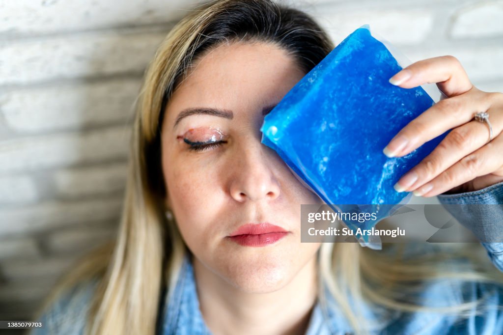 Woman having eyelid surgery applies ice compress to her face