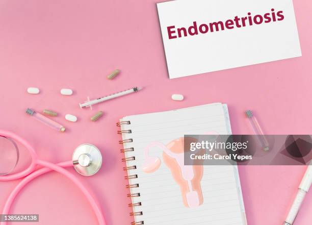 medical desk with notepad  showing endometriosis message.pills, uterus. - cyst stock-fotos und bilder