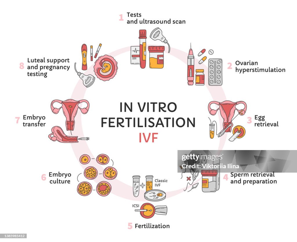 Ivf Computer Background In Vitro Fertilization Ivf Vector Circle Infographic And Infertility ...