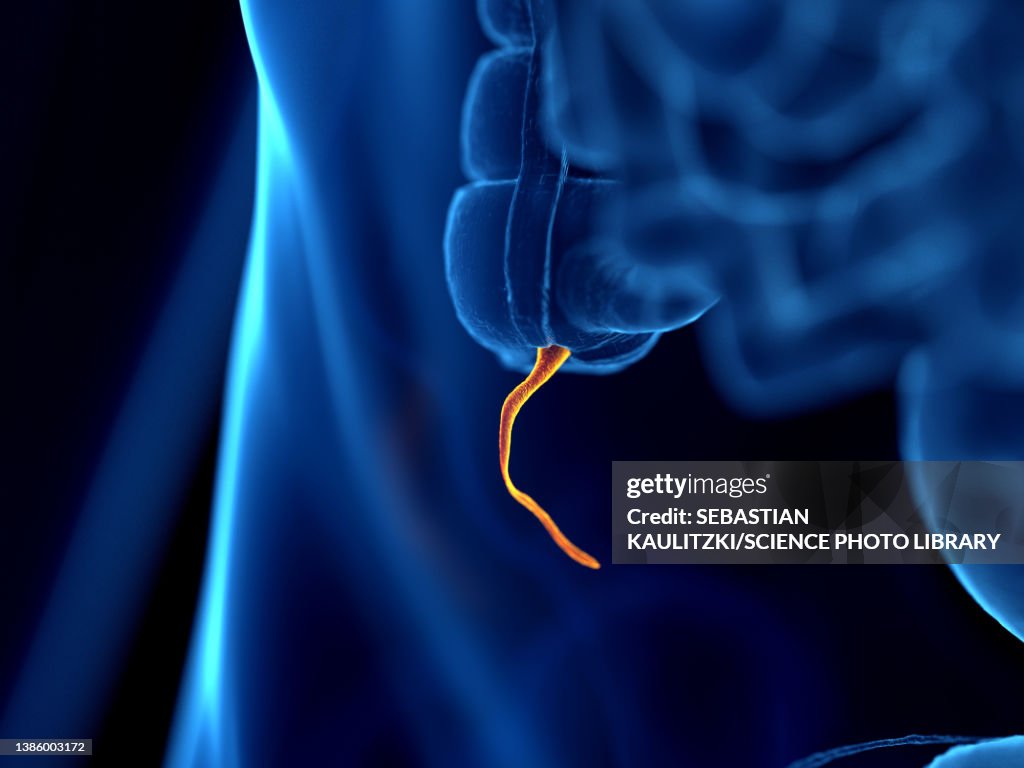 Appendix Realistic Image Human Appendix Illustration High-Res Vector Graphic - Getty Images