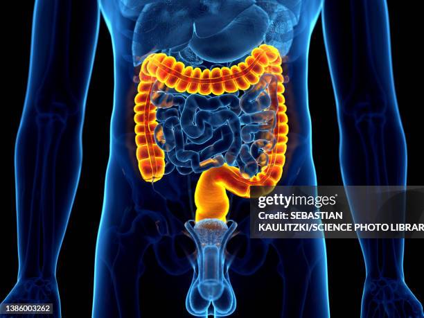 57 Ulcerative Colitis Man Stock Photos, High-Res Pictures, and Images ...