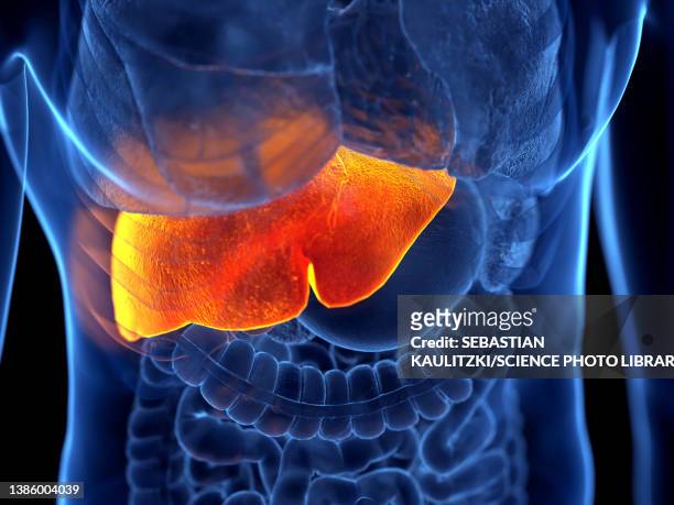 Liver Cirrhosis Photos and Premium High Res Pictures - Getty Images
