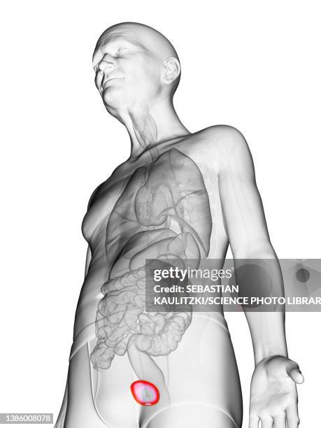 elderly man's urinary bladder, illustration - human bladder stock illustrations