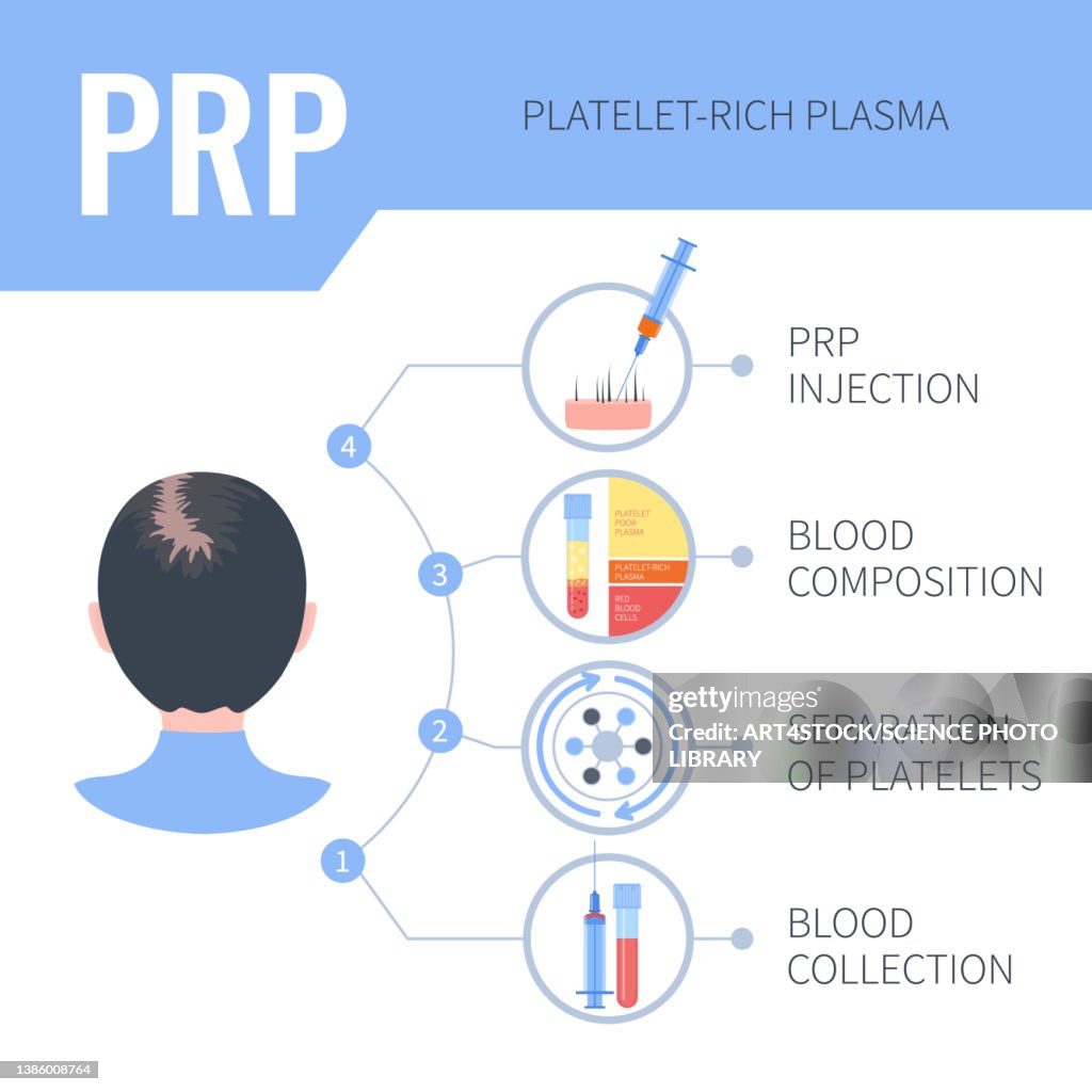 PRP hair regrowth therapy in women, illustration