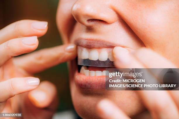 woman using teeth whitening strips - sbiancamento dentale foto e immagini stock