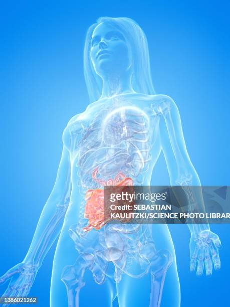 human small intestine, illustration - ulcer stock illustrations
