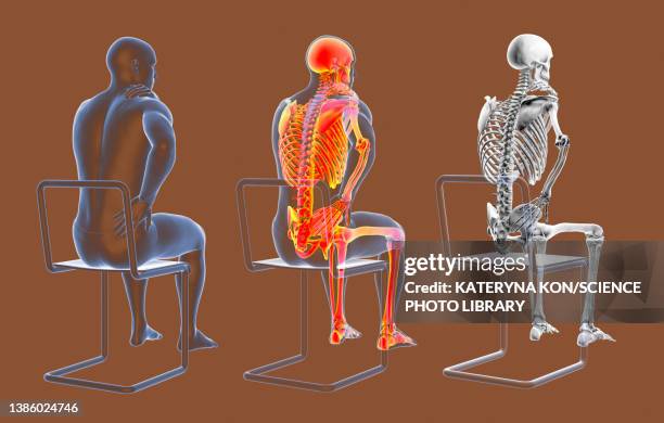 ilustrações de stock, clip art, desenhos animados e ícones de back pain, conceptual illustration - osteoporose