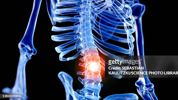 painful back, illustration - intervertebral discs stock illustrations