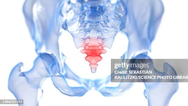 painful coccyx, illustration - tailbone stock illustrations