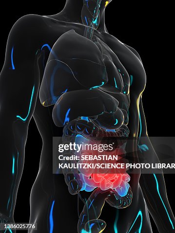 Pinpy Intestines Painful Small Intestine Illustration High-Res Vector Graphic - Getty Images