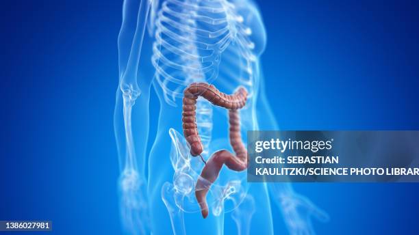 Ulcerative Colitis Man Photos and Premium High Res Pictures - Getty Images