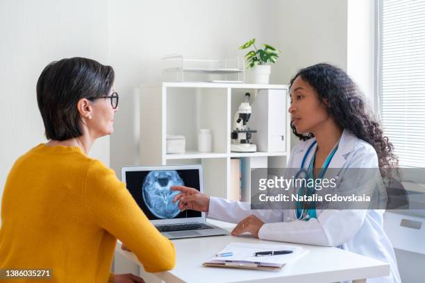 afro-american oncologist discussing medical x-ray scan with mature female patient - ultrasound scan - fotografias e filmes do acervo