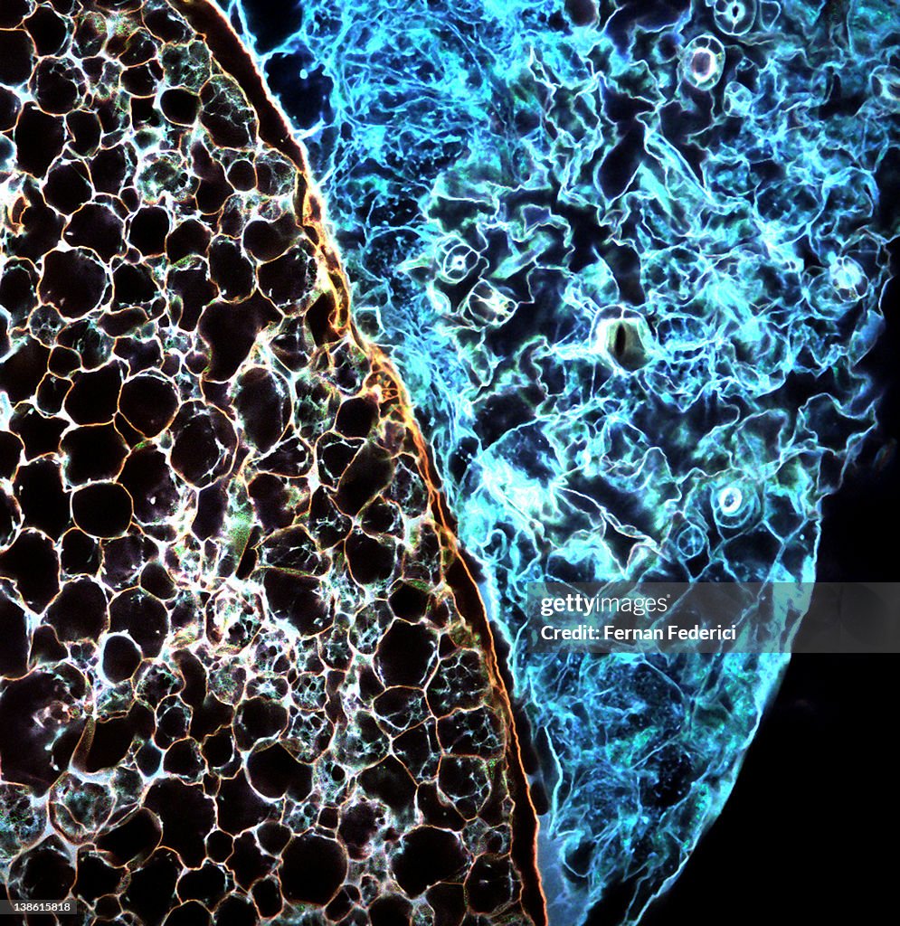 Confocal microscopy of plant cells