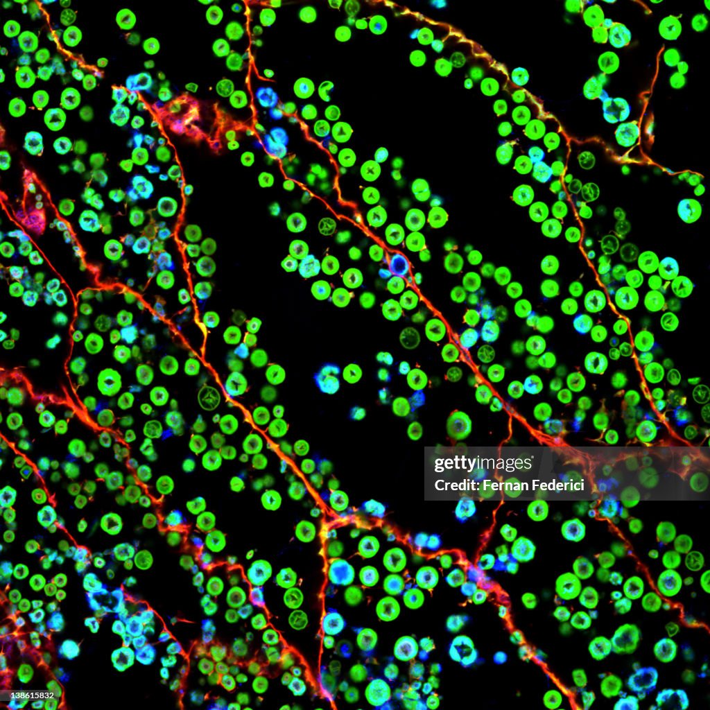 Microscopy of plant cells
