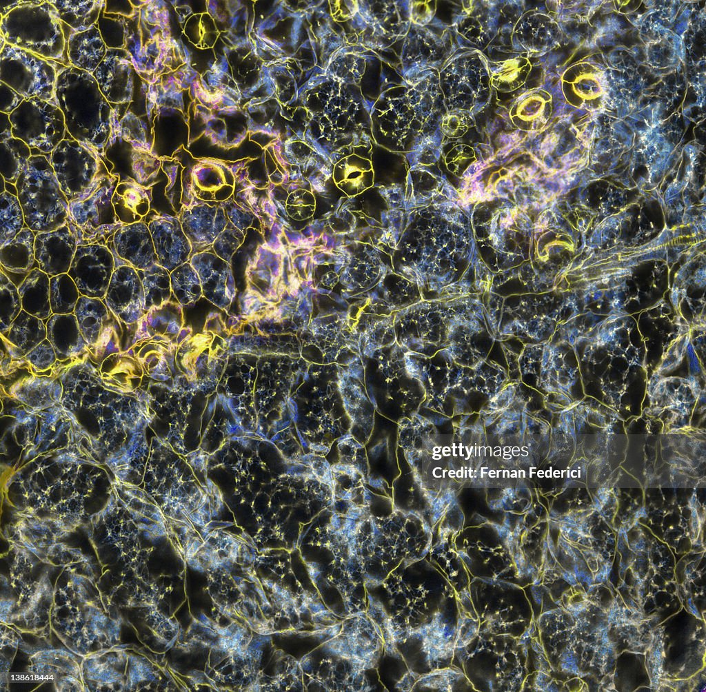 Confocal microscopy plant cells