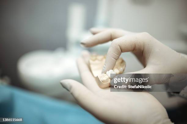 checking dental impression - equipamento protético imagens e fotografias de stock