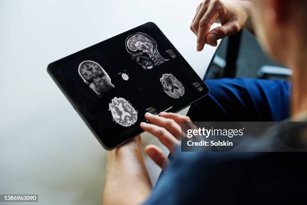 two doctors looking at x-ray images on digital tablet - x ray human stock pictures, royalty-free photos & images