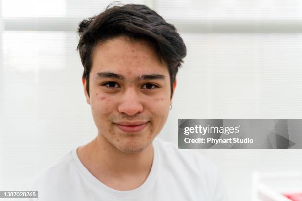 white young guy dressed in a white t-shirt - adult acne stock pictures, royalty-free photos & images