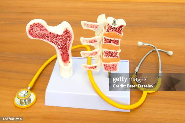 hip replacement and backbone teaching model - hip surgery stock pictures, royalty-free photos & images