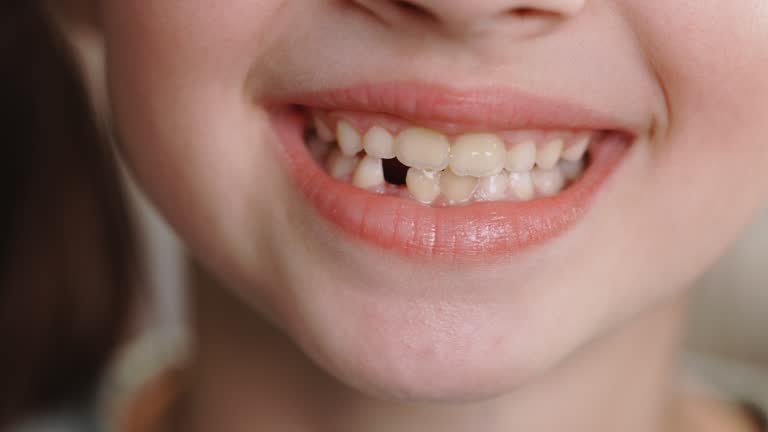 One Tooth Su Close-up mouth child has lost one milk teeth. Replacement of permanent ...