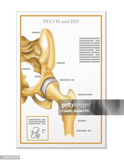doctor's office hip skeleton poster on transparent background. - hip body part 幅插畫檔、美工圖案、卡通及圖標