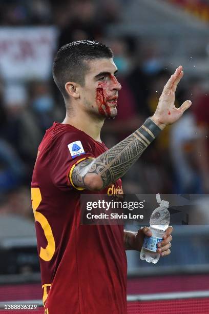 Gianluca Mancini of AS Roma receives a blow to the face and bleeds during the Serie A match between AS Roma v Udinese Calcio