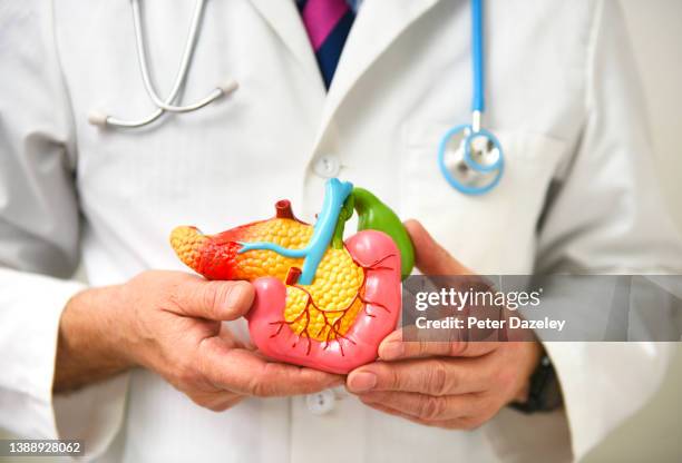 dr with model of pancreas - bauchspeicheldrüsenkrebs stock-fotos und bilder