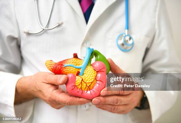 dr with model of pancreas - tumore pancreas foto e immagini stock