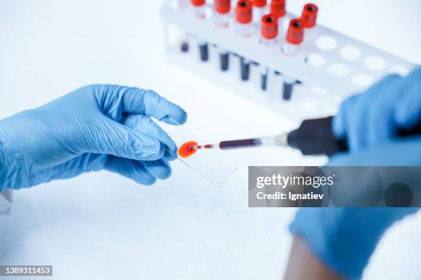 hands of laboratory assistant in a blue protective gloves, placing a drop of blood on a slide for microscopy from the high angle view - choosing experiment stockfoto's en -beelden