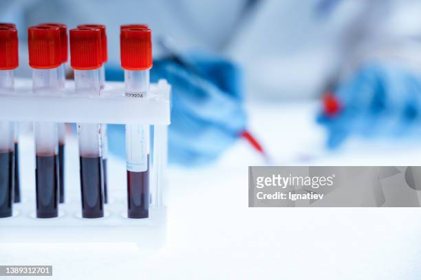 close - up of a test tube rack with blood collecting tubes and a scientist, who's writing test results, sitting in his lab as a blurred background - choosing experiment stockfoto's en -beelden