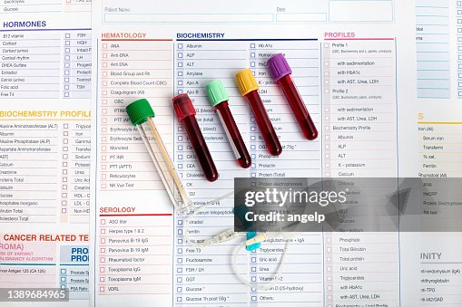 Routine Lab Samples Workplace Of Laboratory With Blood Tubes Samples And Requisition Form ...