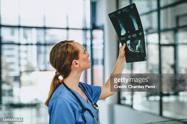 shot of a young doctor analysing an x ray of a foot in a hospital - praticando imagens e fotografias de stock