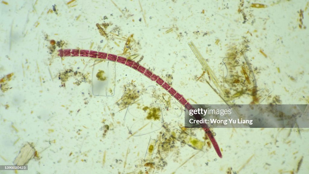 Red cyanobacteria under microscope view
