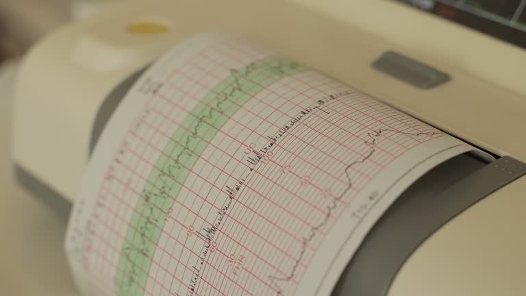 Cardiotocogram Paper Speed Graph Chart Paper Videos and HD Footage - Getty Images