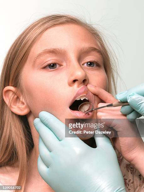 dentist examining 9 year old girl's broken tooth - odontología cosmética fotografías e imágenes de stock