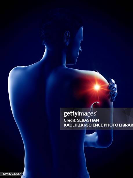 painful elbow, illustration - male anatomy stock illustrations