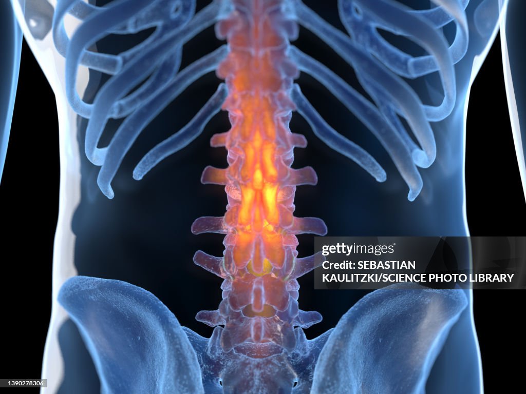 Inflamed Back Illustration High-Res Vector Graphic - Getty Images