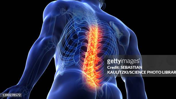 painful back, illustration - human vertebra stock-grafiken, -clipart, -cartoons und -symbole