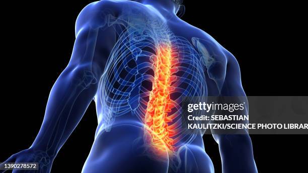 illustrazioni stock, clip art, cartoni animati e icone di tendenza di painful back, illustration - vertebrae