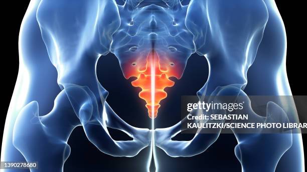 painful coccyx, illustration - rheumatism stock illustrations