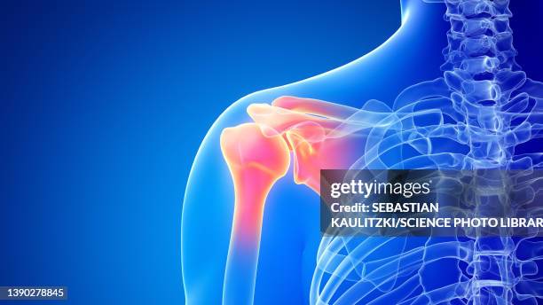 painful shoulder, illustration - clavicle stock illustrations